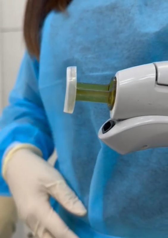 قطعة الليزر لازالة الشعر استخدام مرة واحدة مقاس 18